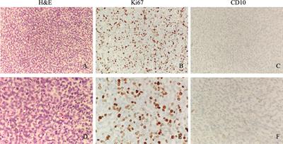Case Report: An Adolescent Soft Tissue Sarcoma With YWHAE-NUTM2B Fusion Is Effectively Treated With Combined Therapy of Epirubicin and Anlotinib